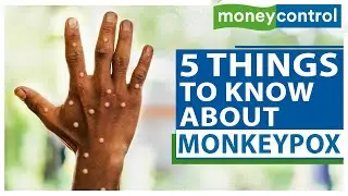 First Monkeypox Case In Delhi | WHO Declares Health Emergency | All You Need To Know | GLOBAL HEALTH