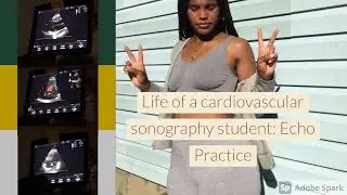 Life Of A Cardiovascular Sonography Student: Echo Practice