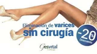 Eliminar Varices Madrid - Gesvital