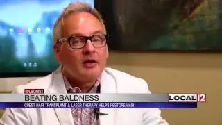 Chest hair transplant and laser therapy helps restore hair