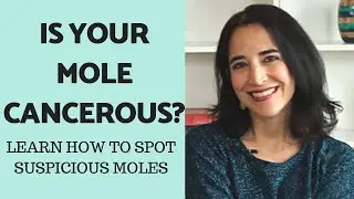 When to Worry About a Mole