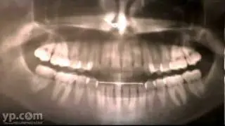 Phoenix Teeth Whitening Valley of The Sun Dentistry