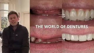 Let's Delve Into The World Of Dentures