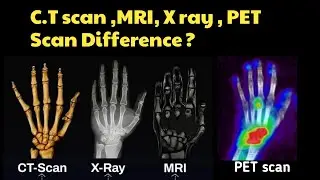 Разница между КТ, рентгеном, МРТ и ПЭТ-сканированием.