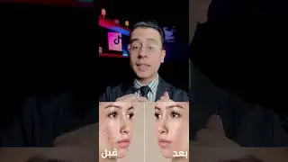 كريم السحر اللي هايغير بشرتك