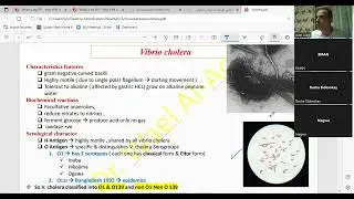 vibrio cholera