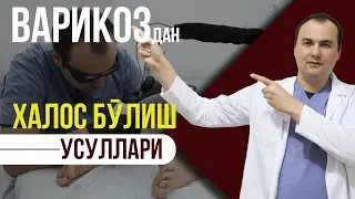 ❓ Варикоздан қандай қутулиш мумкин