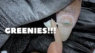 Greenies! What are they? What to do??