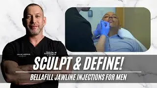 Bellafill Injections for Male Jawline | Live with Dr. Jason Emer