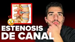 ¿Tienes Hernia y Estenosis? Evita la Operación con esta SOLUCIÓN REAL