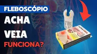 VENOSC&Oacute;PIO ACHA VEIA FUNCIONA? | DEVO COMPRAR UM VENOSC&Oacute;PIO ACHA VEIA? | VENOSC&Oacute;PIO E FLEBOSC&Oacute;PIO