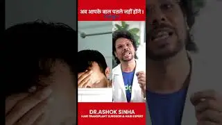 बालों का पतला होना | Thinning Hair | Hair loss | Hair fall | Hair Regrowth | #hairfall | Adon