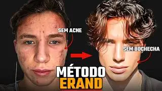 Homem FEIO teve GLOW UP e virou MODELO da CALVIN KLEIN (M&eacute;todo Completo Explicado)