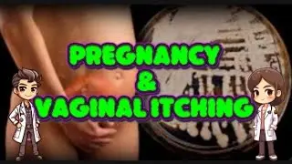 PREGNANCY AND VAGINAL ITCHING