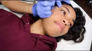 all about my TATTOO FRECKLES | Chandler Alexis