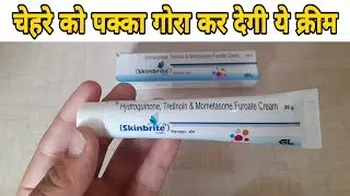 Skinbrite Cream Review / fairness cream review