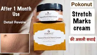 Pokonut Stretch Marks Cream | Pokonut strech marks cream honest reveiw  | strech marks cream