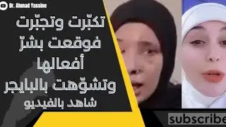 شاهد بالفيديو زينبية تجبّرت وتكبّرت فدفعت ثمن أفعالها بعد أن تشوّهت بالبايجر