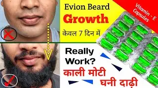 Evion Beard Growth || Evion Benefits For Male || Evion 400 For Beard Growth || How to Grow Beard