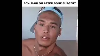 Marlon finally got nerfed 🙏 | Marlon Edit | #marlon #mar3lg #fypシ #foryou #looksmaxxing #shorts