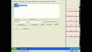 apple EMR solution for capturing ekg/ecg remotely