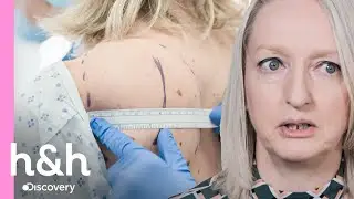 Gini tiene un gran lipoma en la espalda | Clinica de la Piel | Discovery H&H Latinoamérica