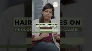 How does hair patch damages your skin? Know the truth | DMC Trichology