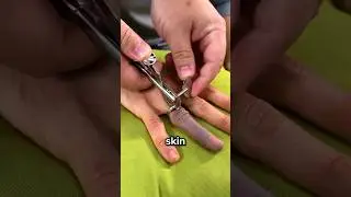 How To Actually Remove A Stuck Ring