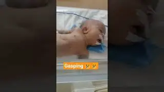 gasping #gasping #babies #neonatologist #neonatalicu #neonatalintensivecareunit #cute #nicu #newborn