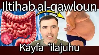 Kayfa tukhfif iltihab al-qulun aw al-qulitis wa al-takhallus min al-alam, al-ishal, al-imsak wa su&rsquo;