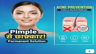 Pimples से छुटकारा पने का पक्का तारखा #pimplecare #acnetips #skincare #skincareroutine 