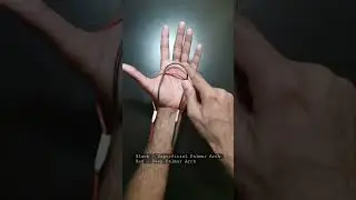 TCML - Wire #shorts #tcml #anatomy