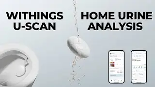 Withings U Scan Review | Is It Worth Your Money?