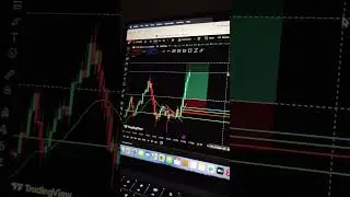Gold Trade done and proper setup and logic base trade