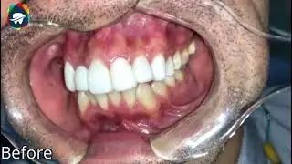 Same Day Smile