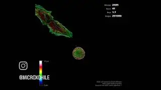 C&eacute;lula U2OS que expresa Lifeact-tdTomato con Microscopio🔬Lattice Lightsheet 7 ZEISS