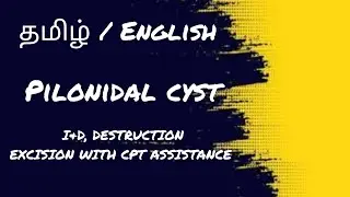 Pilonidal cyst#CPT #MEDICAL CODING#SURGERY #TAMIL AND ENGLISH EXPLANATIONS