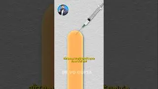 Top 5 benefits of Botox for Men #drvijayantgovinda