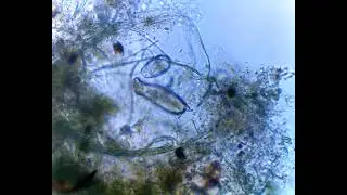 Gastrotrich in trap#aquarium #microscope #microscopeworld #microscopicview #microscopy
