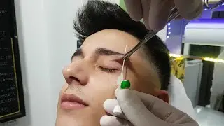 Eyebrow Kaş Piercing Deldirme İyileşme S&uuml;resi ??