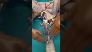 Одна вещь, к которой я почти НИКОГДА не прикасаюсь как акушер-гинеколог 🤣 #акушер-гинеколог #кажд...