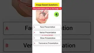 Image Based Question For Norcet | IBQ For Norcet #mhsrb  #nursing #aiims #norcet  #rrb #ibq #shorts