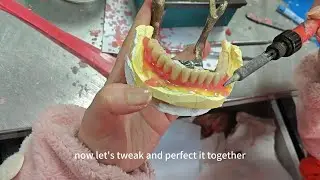 Complete Acrylic Denture#waxbae #denture