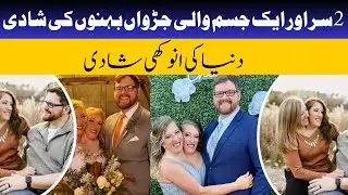 Marriage of the most famous conjoined twins | Amazing video