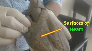 Surfaces and Borders of the heart anatomy | heart borders | heart surfaces
