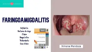 FARINGOAMIGDALITIS: agentes infecciosos, clínica, diagnóstico, tratamiento, caso clínico #ENARM
