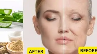 *DIY SKIN TIGHTENING challenge: remove wrinkles fine lines AND OPEN PORES* (3 STEPS)