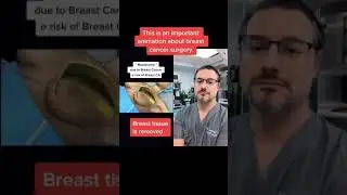 Операция по удалению рака груди #шорты