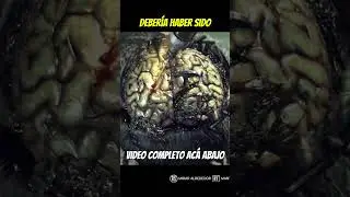 The Evil Within (AKUMU), Como Resolver El Segundo Puzzle De Cerebros 🧠#shorts