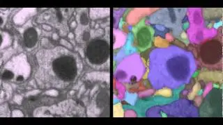Automatic Segmentation of Electron Microscopy Images of Fly Brain - 3